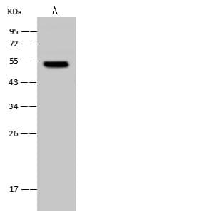 Polyclonal Rabbit anti-Human UMPS / OPRT Antibody (IHC, WB)