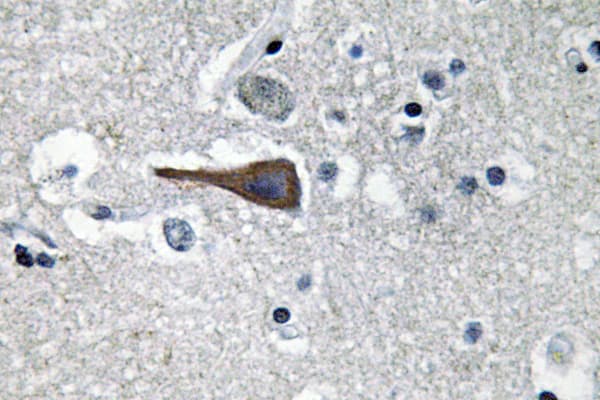 CCK / Cholecystokinin Antibody (aa46-95)