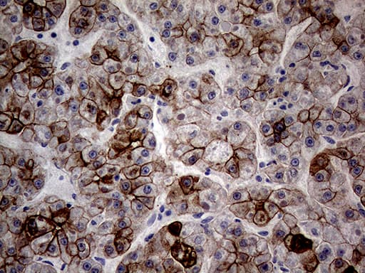 Monoclonal Mouse anti-Human KRT18 / CK18 / Cytokeratin 18 Antibody (clone OTI10H8, Carrier-free, aa69-372, IHC, WB)