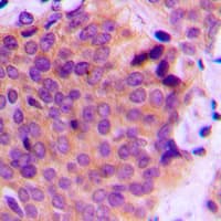 MMP2 Antibody (C-Terminus)