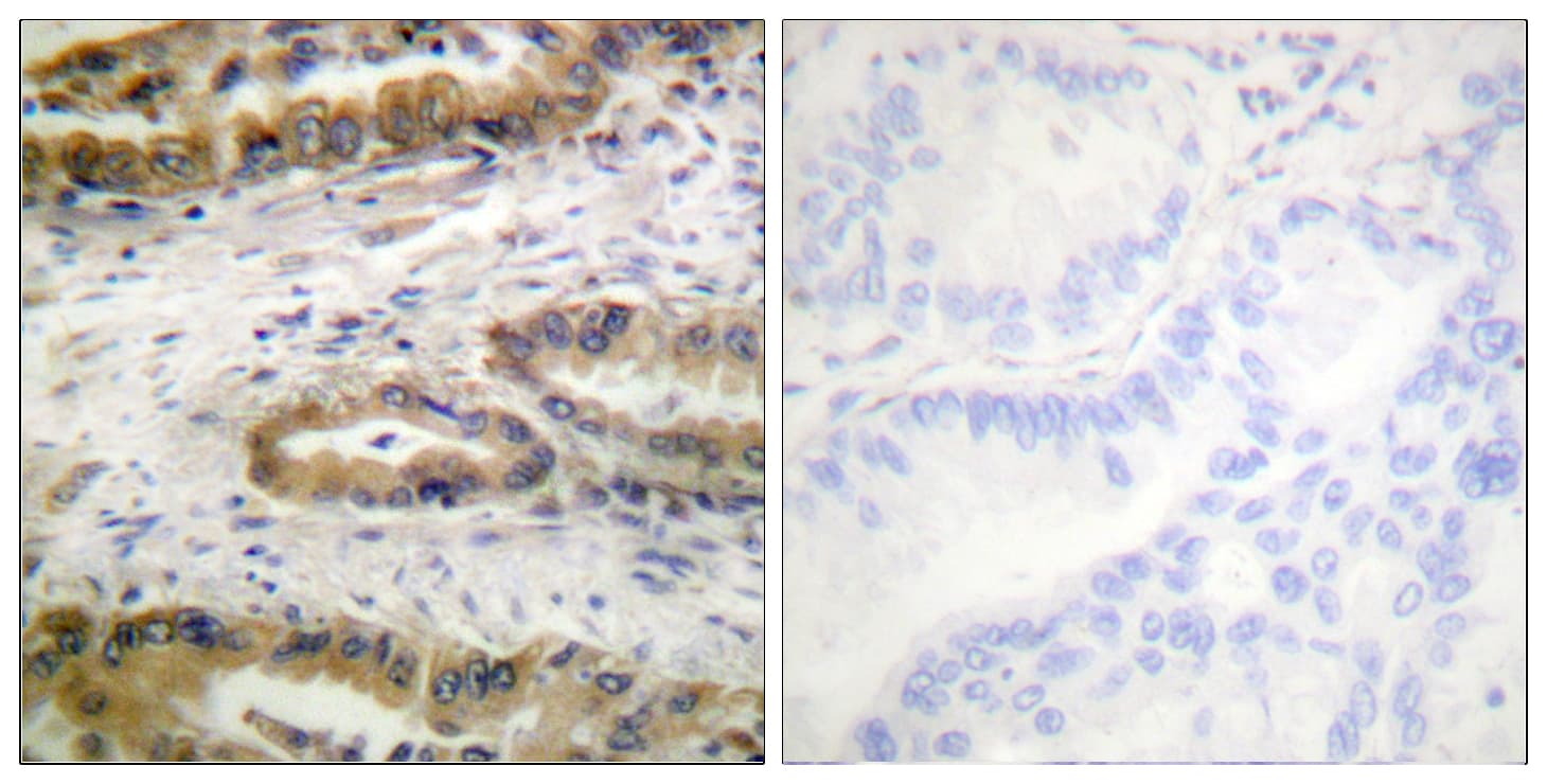 Polyclonal Rabbit anti-Human KDR / VEGFR2 / FLK1 Antibody (phospho-Tyr1054, IHC)