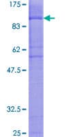 Human SIPA1L2 Protein (Recombinant GST)
