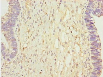CALCOCO2 Antibody