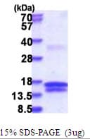 Human UCK1 Protein (Recombinant His)