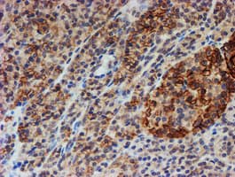 Monoclonal Mouse anti-Human FXYD3 Antibody (clone OTI1E8, IHC, IF, WB)
