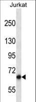 PAN3 Antibody (aa727-755)
