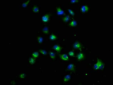 CRB1 Antibody