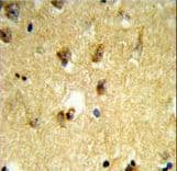 Polyclonal Rabbit anti-Human KCTD12 Antibody (aa242-269, IHC, WB)