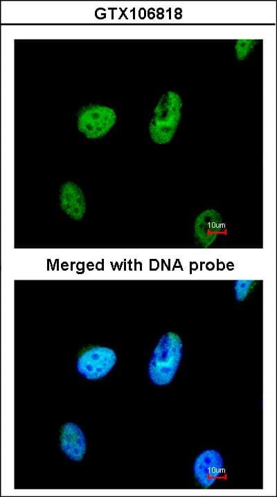 TATDN1 Antibody (aa1-199)