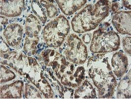 Monoclonal Mouse anti-Human AK3 / Adenylate Kinase 3 Antibody (clone OTI3G1, IHC, IF, WB)