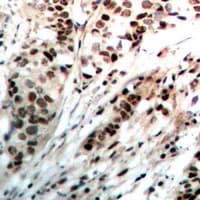 PR / Progesterone Receptor Antibody (Internal)