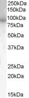 IHC-plus™ PDE4B Antibody (aa723-736)