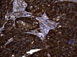 NME1 / NM23 Antibody (clone OTI6E8)