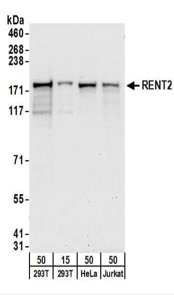 IHC-plus™ Polyclonal Rabbit anti-Human HUPF2 / UPF2 Antibody (aa1-50, IHC, WB)