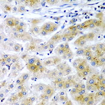 RARRES2 / Chemerin Antibody