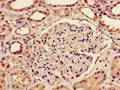 BMP2 Antibody