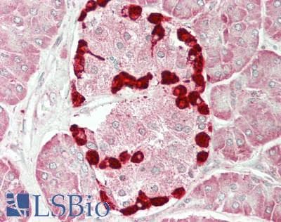 IHC-plus™ Polyclonal Rabbit anti-Human MLST8 / GBL Antibody (IHC, WB)