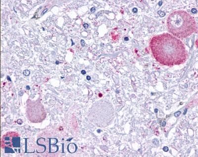 PathPlus™ Polyclonal Rabbit anti-Human GPR34 Antibody (Cytoplasmic Domain, IHC)