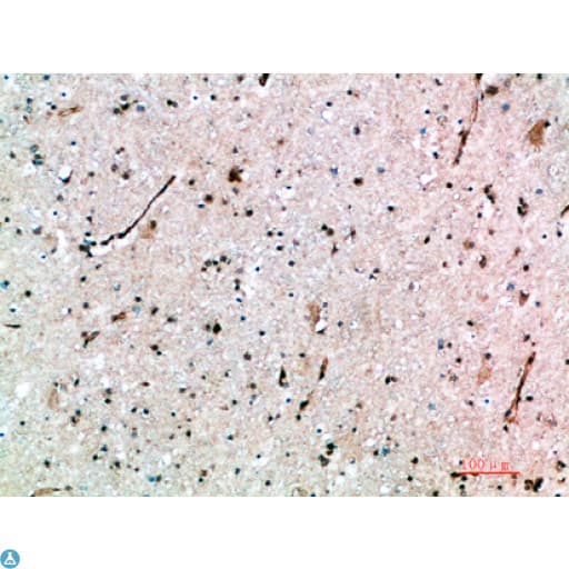 Polyclonal Rabbit anti-Human AVPR1B Antibody (IHC)
