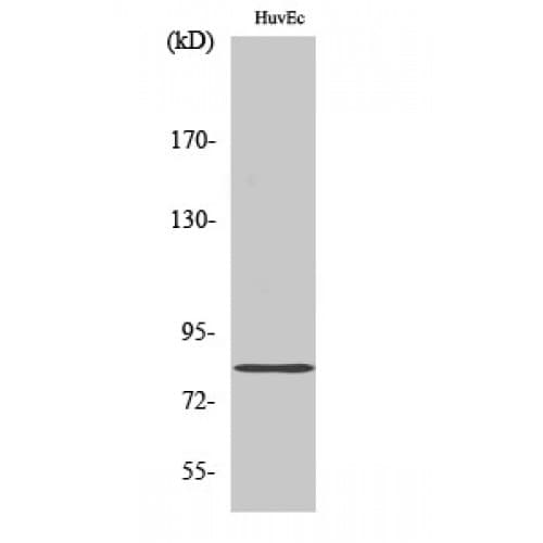 RDX / Radixin Antibody (120-200 aa, Internal)