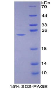 Human NCF2 / NOXA2 / p67phox Protein (Recombinant His-T7)