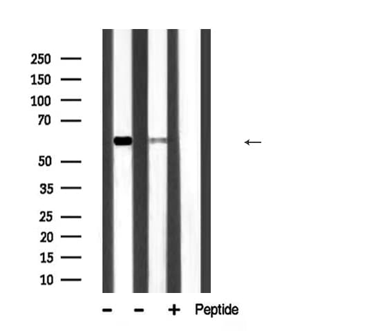 SQSTM1 Antibody
