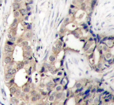 Polyclonal Rabbit anti-Human ABL1 / c-ABL Antibody (phospho-Tyr412, IHC, IF)