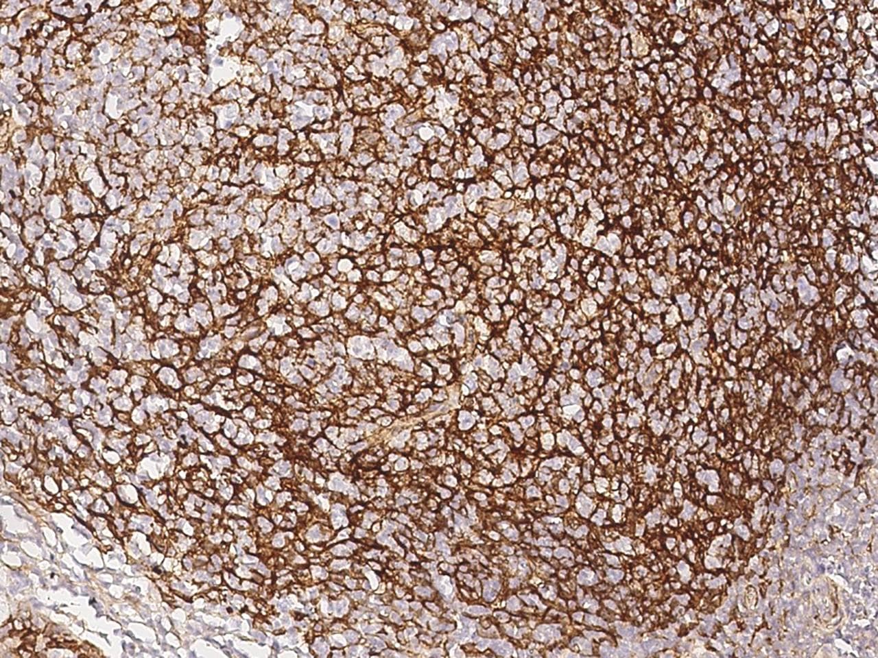 Polyclonal Rabbit anti-Human VCAM1 / CD106 Antibody (Preservative Free, IHC)