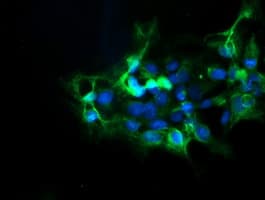 DPH2 Antibody (clone OTI3A12)