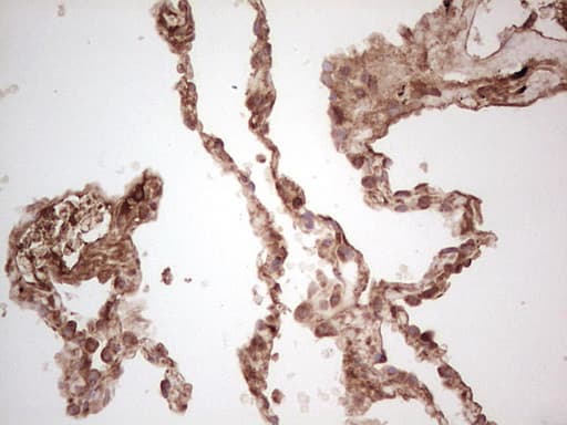 UBE2D2 / UBCH5B Antibody (clone OTI1D11)