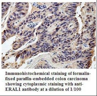 Polyclonal Rabbit anti-Human ERAL1 Antibody (aa72-225, IHC, WB)