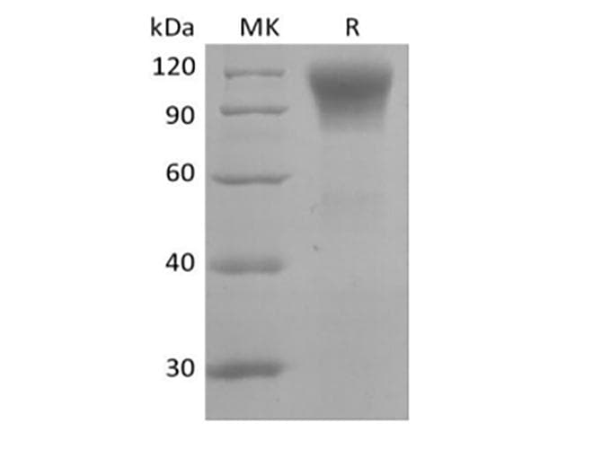 Human CD45RO Protein (Recombinant 6His, C-terminus)