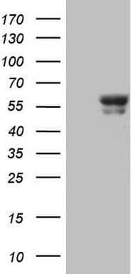 BTBD3 Antibody (clone OTI1A10)