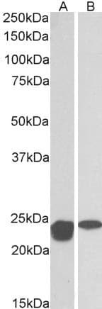 PathPlus™ SOD2 / Mn SOD Antibody (aa119-130)