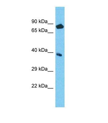 Polyclonal Rabbit anti-Human NPEPL1 Antibody (aa110-159, WB)