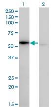WARS Antibody (clone 3A12)