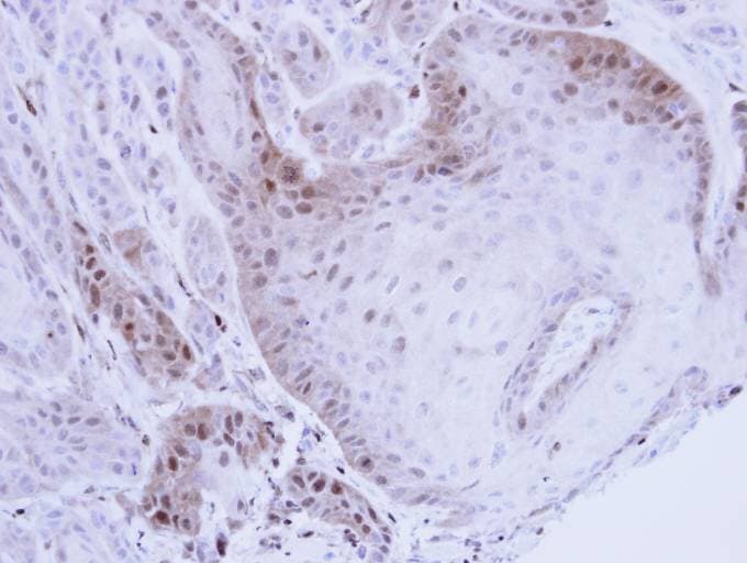 PSMB8 / LMP7 Antibody (aa52-276)