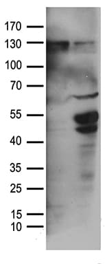 TGFB2 / TGF Beta2 Antibody