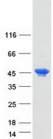 Human TCP10L2 Protein (Recombinant Myc-DDK (Flag))