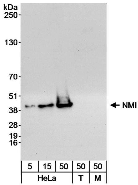 Polyclonal Rabbit anti-Human NMI Antibody (aa250-C-term, IHC, WB)