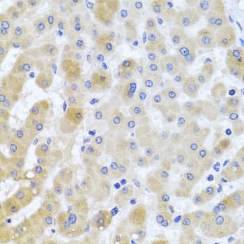 EIF3M / PCID1 Antibody
