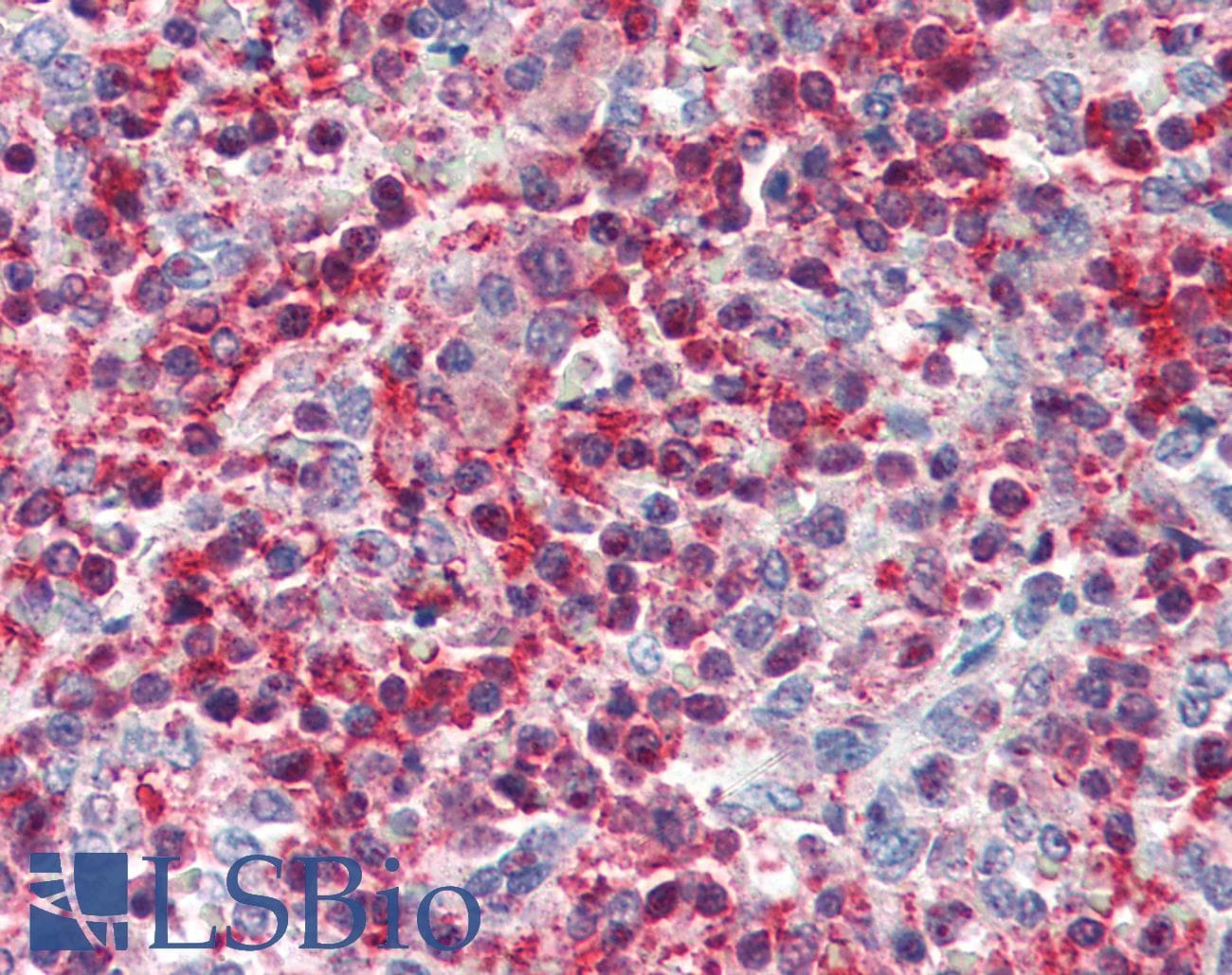 IHC-plus™ PLEK / Pleckstrin Antibody (aa337-350)
