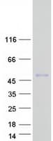 Human MEF2B Protein (Recombinant Myc-DDK (Flag))