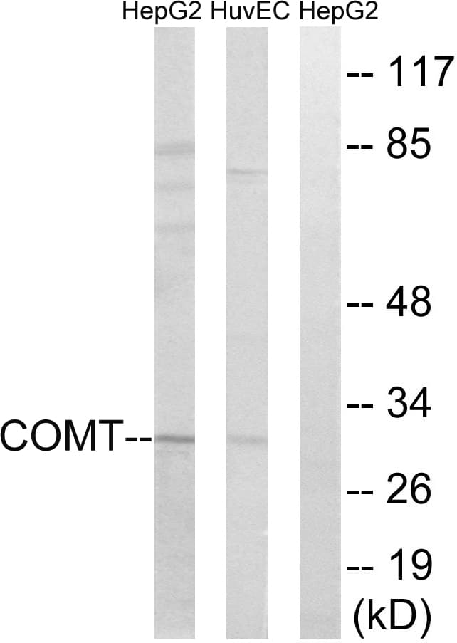 COMT Antibody (aa61-110)