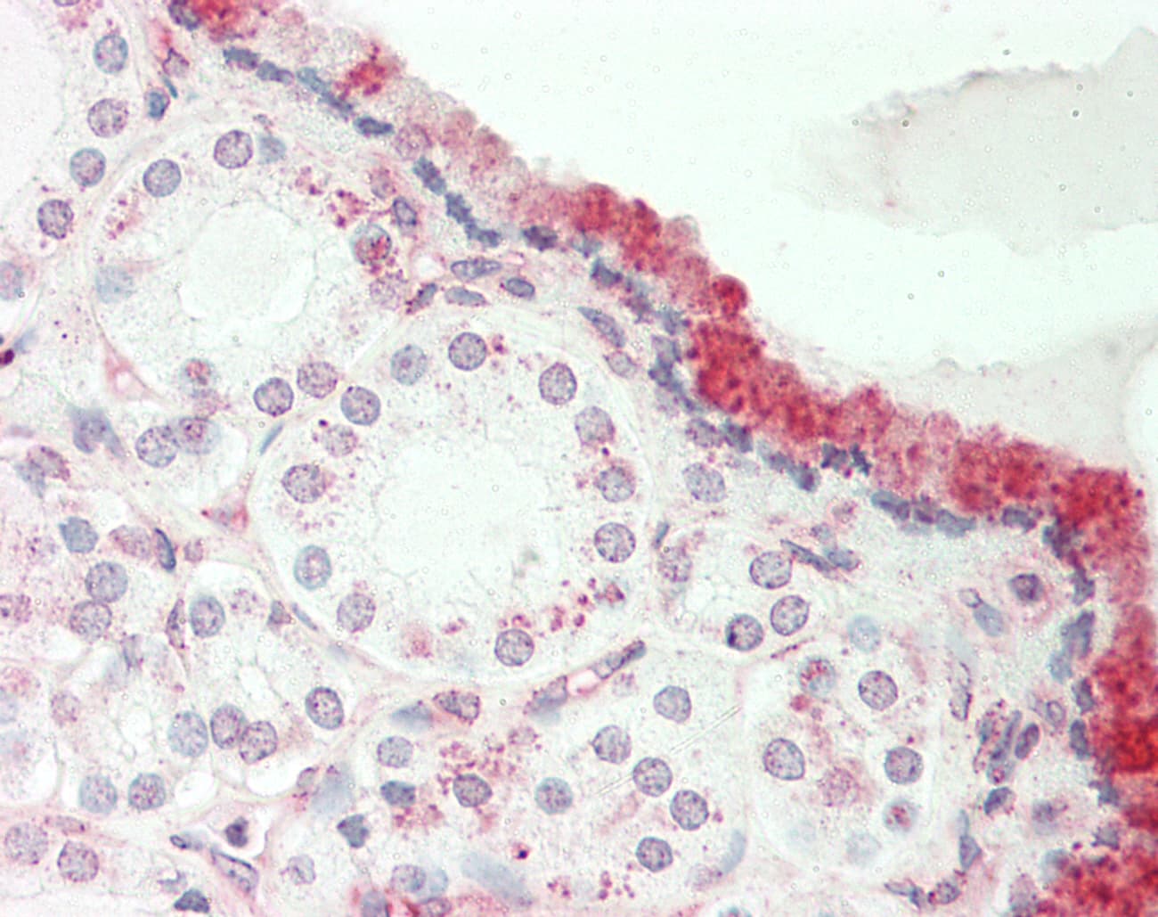 PLA2G4B Antibody (aa651-700)