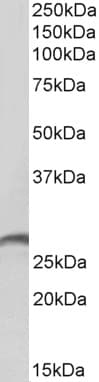 IHC-plus™ PRTN3 / Myeloblastin Antibody (aa88-98)