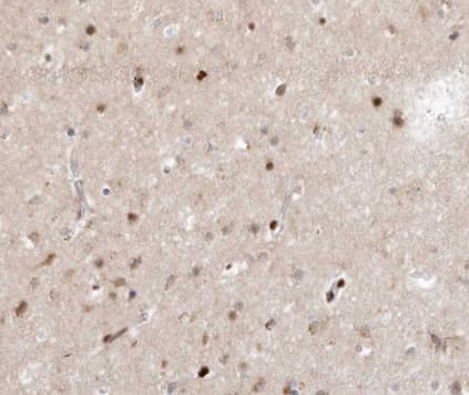 Polyclonal Rabbit anti-Human SENP7 Antibody (IHC, IF, WB)