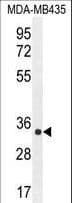 Polyclonal Rabbit anti-Human ALKBH6 Antibody (aa116-145, IHC, WB)