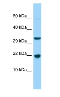 Polyclonal Rabbit anti-Human CABP5 Antibody (N-Terminus, WB)