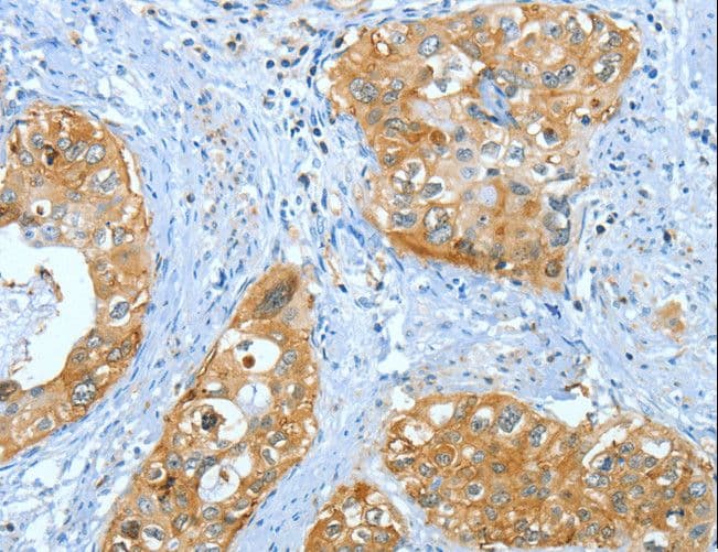 Polyclonal Rabbit anti-Human ANXA3 / Annexin A3 Antibody (IHC, WB)